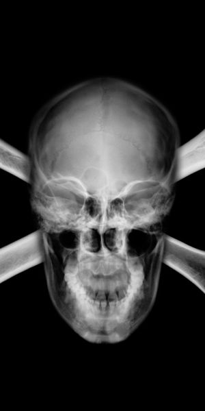 Intriguing Dark Skull Mobile Wallpaper Featuring Crossbones Design